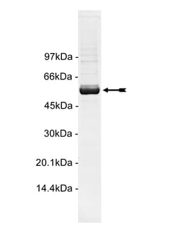 Eurofins DiscoverX MRCK Protein, Active 250 &mu;g | Buy Online | Eurofins DiscoverX | Fisher Scientific